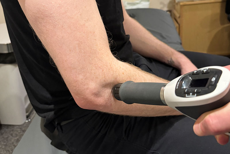 Shockwave Therapy on Elbow